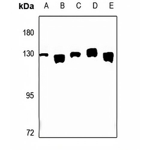 CLIP2 Rabbit Polyclonal Antibody