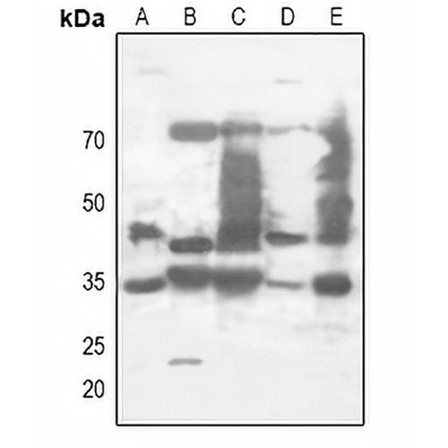 XPA Rabbit Polyclonal Antibody
