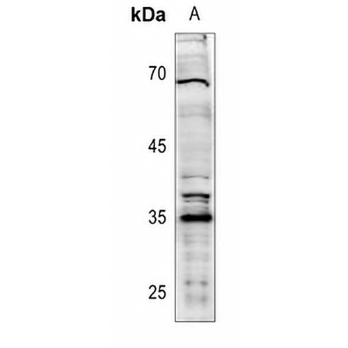 XRCC2 Rabbit Polyclonal Antibody