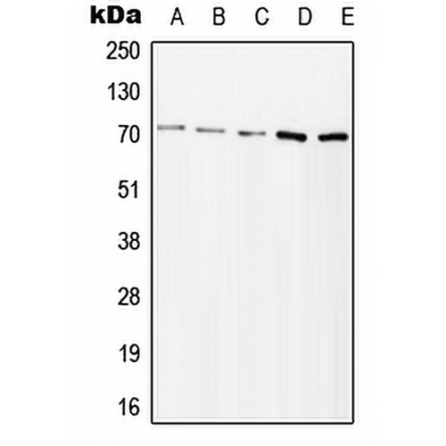 ZAP70 (Phospho-Y315) Rabbit Polyclonal Antibody
