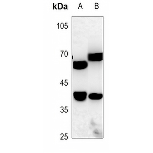ZNF187 Rabbit Polyclonal Antibody