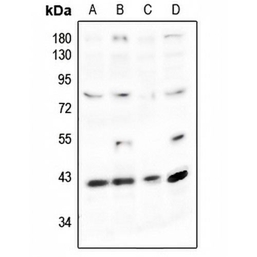 Podocin Rabbit Polyclonal Antibody