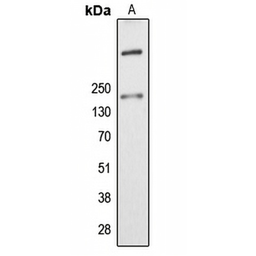 ALMS1 Rabbit Polyclonal Antibody