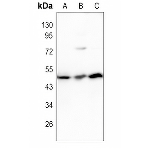 PAX8 Rabbit Polyclonal Antibody