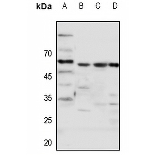 Frizzled 5 Rabbit Polyclonal Antibody