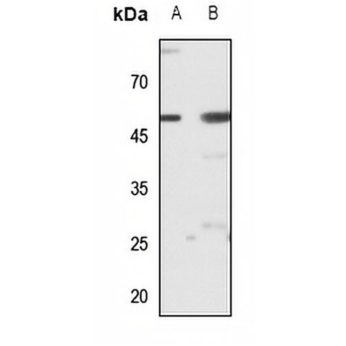 ZIP7 Rabbit Polyclonal Antibody