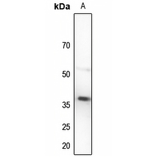 TUSC3 Rabbit Polyclonal Antibody