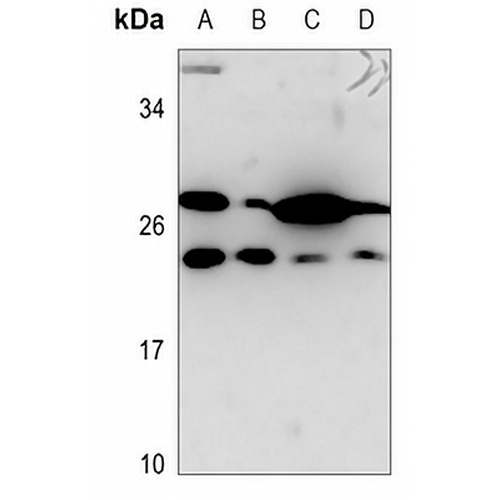 PSCA Rabbit Polyclonal Antibody