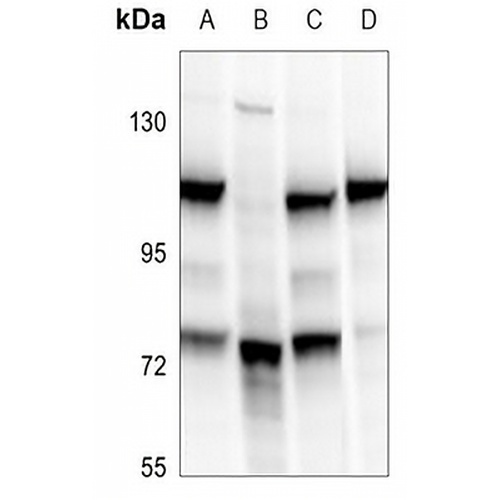 BRD3 Rabbit Polyclonal Antibody