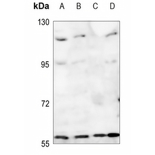 Adracalin Rabbit Polyclonal Antibody