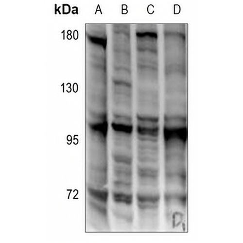 EOMES Rabbit Polyclonal Antibody