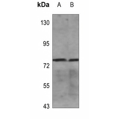 Frizzled 6 Rabbit Polyclonal Antibody