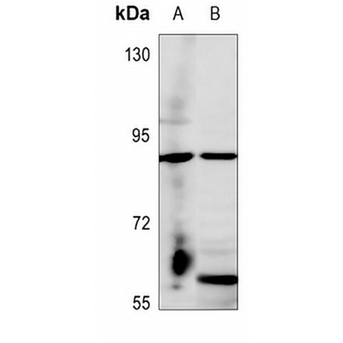 Frizzled 6 Rabbit Polyclonal Antibody