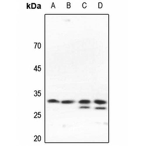 SLC25A11 Rabbit Polyclonal Antibody