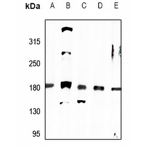 MRCK alpha Rabbit Polyclonal Antibody