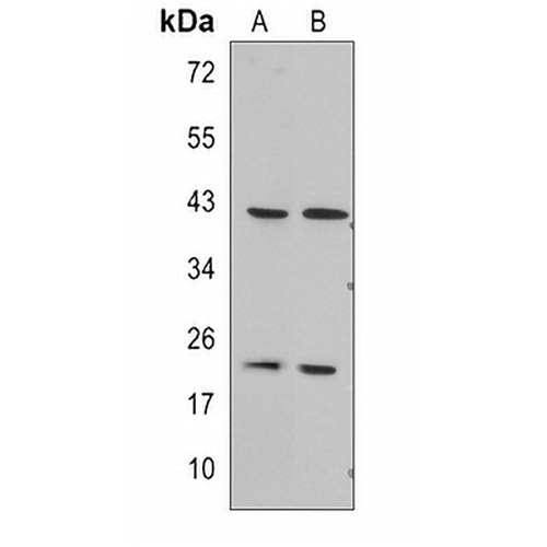 RGS5 Rabbit Polyclonal Antibody