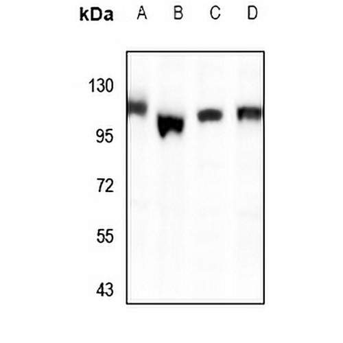 PPFIBP1 Rabbit Polyclonal Antibody