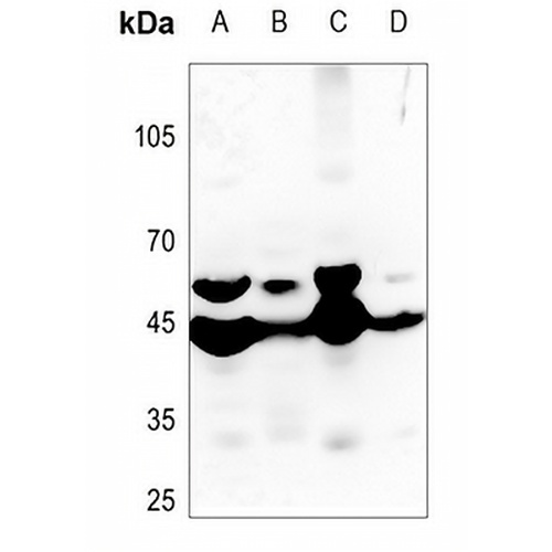 MMP23 Rabbit Polyclonal Antibody