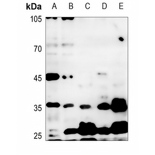 IKK gamma Rabbit Polyclonal Antibody