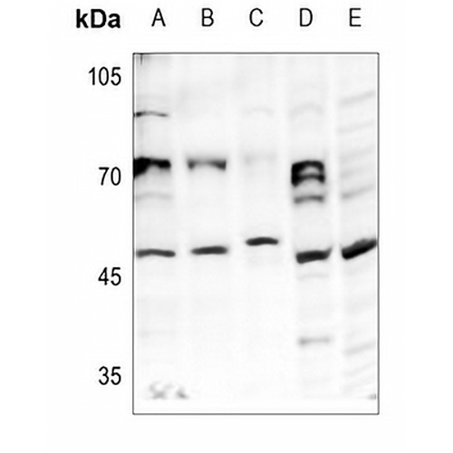 HAT1 Rabbit Polyclonal Antibody