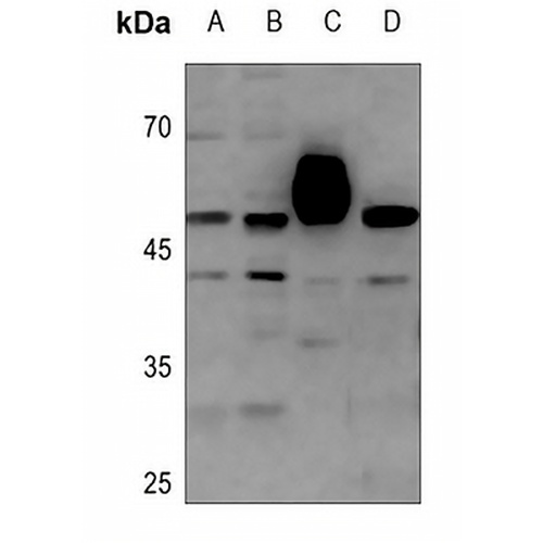 COPS3 Rabbit Polyclonal Antibody