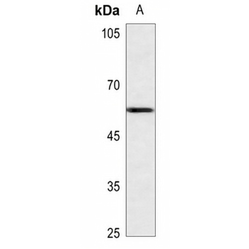 API5 Rabbit Polyclonal Antibody