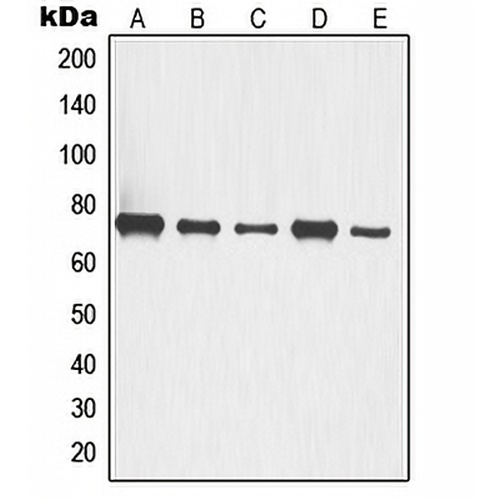 p63 Rabbit Polyclonal Antibody