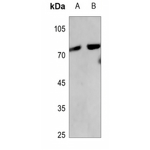 p63 Rabbit Polyclonal Antibody