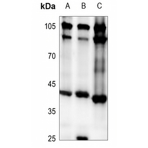 RPC Rabbit Polyclonal Antibody