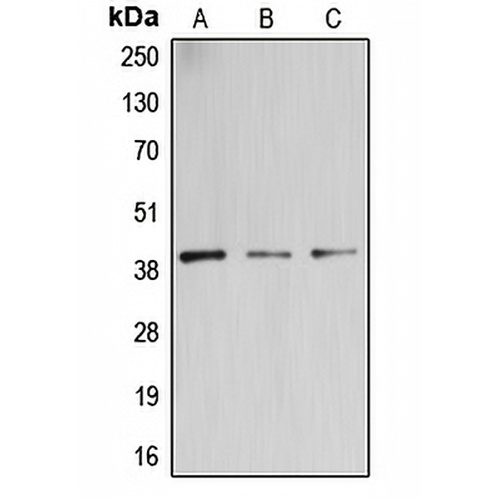 B3GALT4 Rabbit Polyclonal Antibody