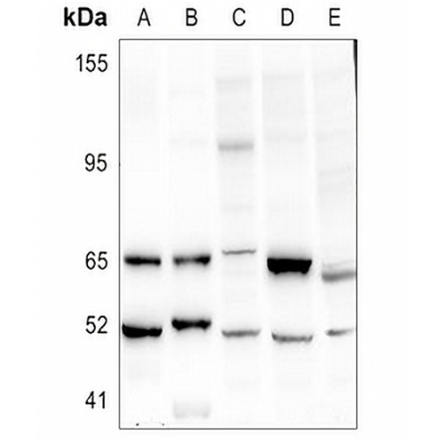 URI1 Rabbit Polyclonal Antibody