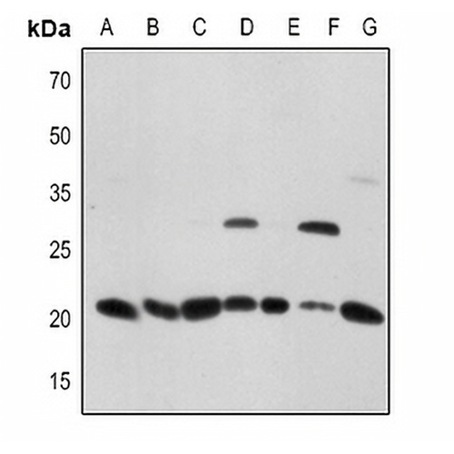 CD256 Rabbit Polyclonal Antibody
