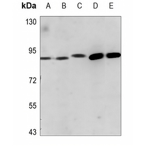 ADAM23 Rabbit Polyclonal Antibody