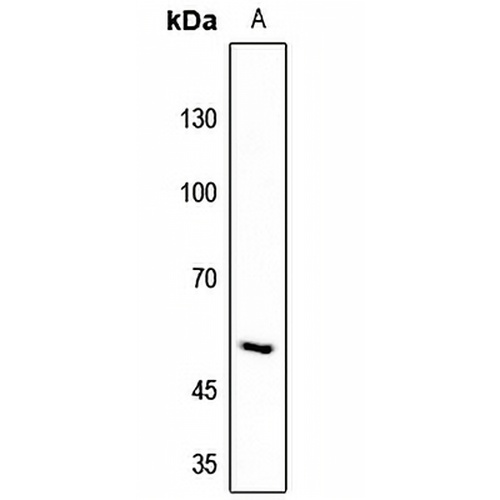 RIOK3 Rabbit Polyclonal Antibody
