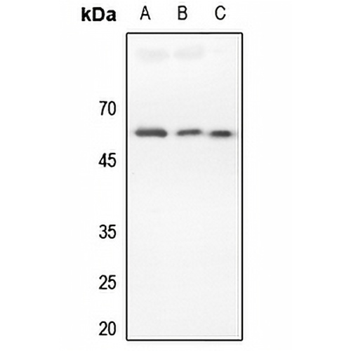 DR4 Rabbit Polyclonal Antibody