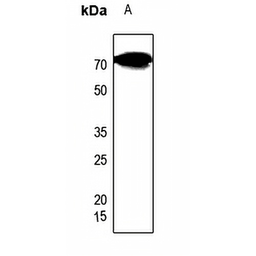CES2 Rabbit Polyclonal Antibody