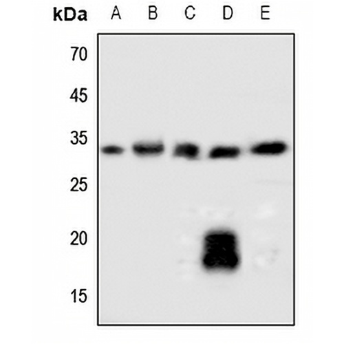 SOCS2 Rabbit Polyclonal Antibody
