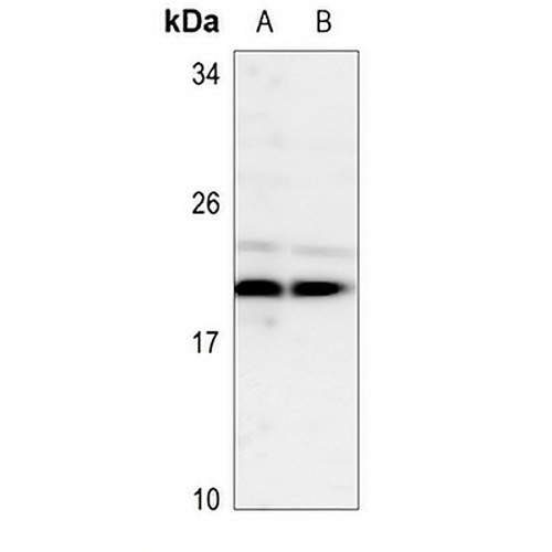 TSC22 Rabbit Polyclonal Antibody