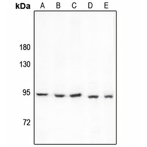 PCAF Rabbit Polyclonal Antibody