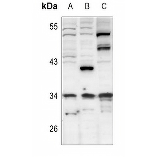 CDK5R1 p35 Rabbit Polyclonal Antibody