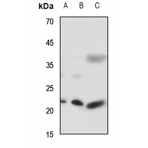 RAB7L1 Rabbit Polyclonal Antibody