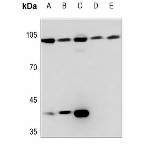 Topoisomerase 3 beta1 Rabbit Polyclonal Antibody