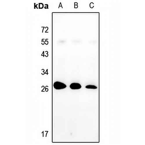 Nop30 Rabbit Polyclonal Antibody