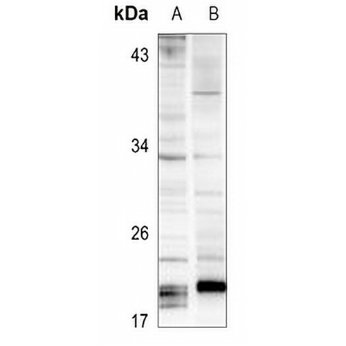 SOCS3 Rabbit Polyclonal Antibody
