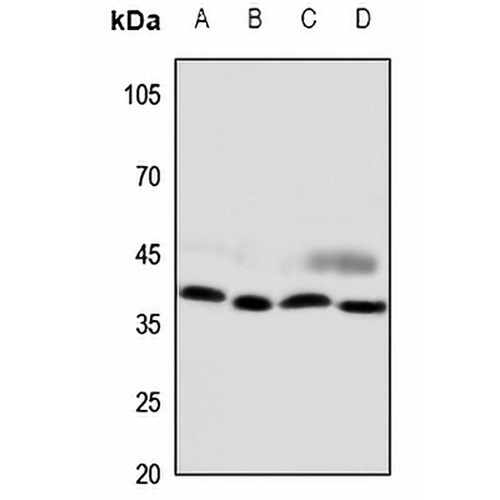 CCRL2 Rabbit Polyclonal Antibody