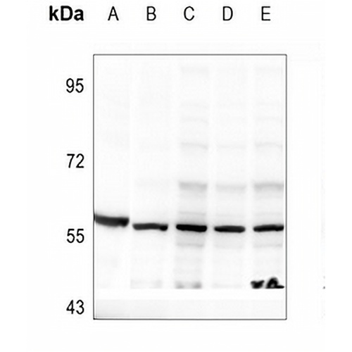 DOK2 (Phospho-Y299) Rabbit Polyclonal Antibody