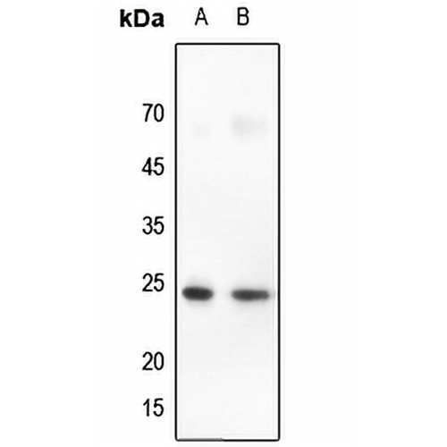 Claudin 10 Rabbit Polyclonal Antibody