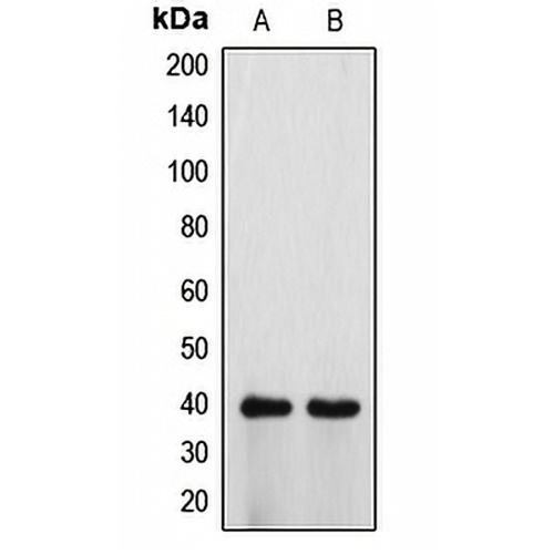 ATP6V0D1 Rabbit Polyclonal Antibody