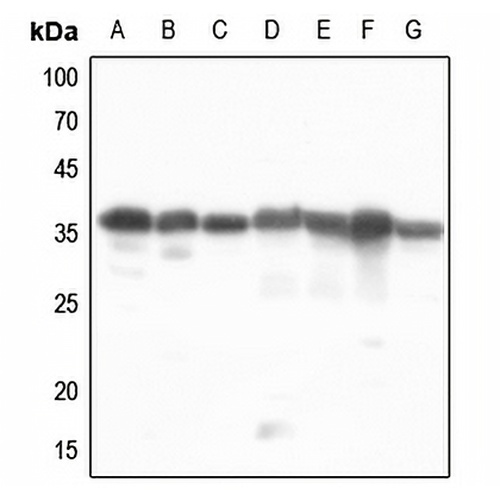 PDLIM1 Rabbit Polyclonal Antibody