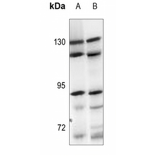 ARHGEF1 Rabbit Polyclonal Antibody